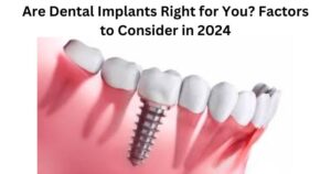 dental implants images