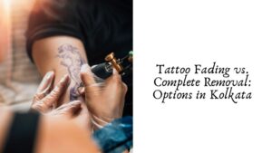 Tattoo Fading vs. Complete Removal: Options in Kolkata