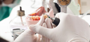 dental lab services